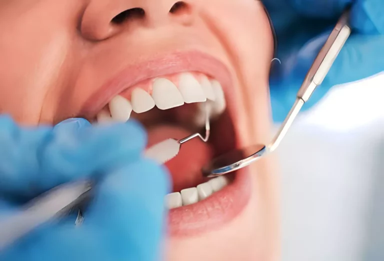 Gengivoplastia