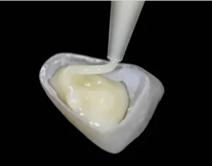 Curso Laminados Cerâmicos Cimentação - Curso de Lentes de Contato Dental