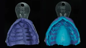 Curso Laminados Cerâmicos Moldagem - Curso de Lentes de Contato Dental